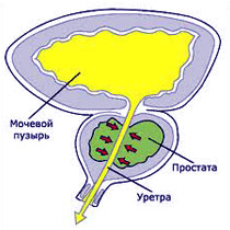 Картинка-анонс к статье Уретропростатит у мужчин: причины развития заболевания и методы лечения